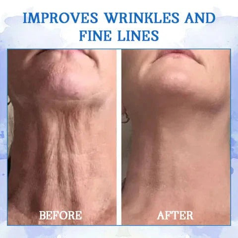 Fubsta™ Advanced Skin Tightening Rejuvenating Cream ( BUY 1 GET 1 FREE )⭐️⭐️⭐️⭐️ 4.9/5 Reviews