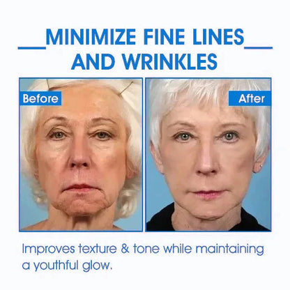 Fubsta™ Advanced Skin Tightening Rejuvenating Cream  ( BUY 1 GET 1 FREE )⭐️⭐️⭐️⭐️ 4.9/5 Reviews