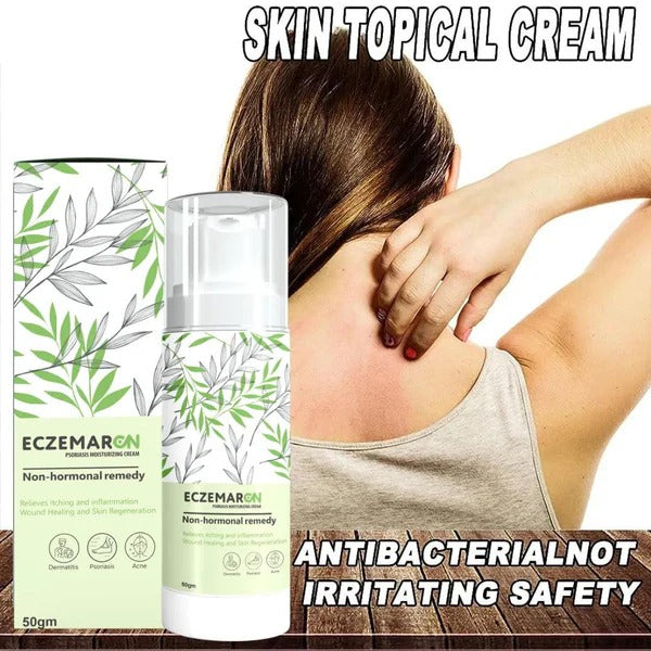 Eczemaron Anti Fungal Cream 50gm | Buy 1 Get 1 Free | ⭐️⭐️⭐️⭐️ 4.9/5 Reviews