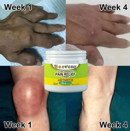 (Pack of 3) BeeTherapy™ #1 Bee Venom Pain Relief Cream | Buy 1 Get 2 Free | ⭐️⭐️⭐️⭐️ 4.9/5 Reviews